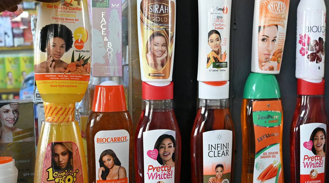 Why skin lightening persists among African women